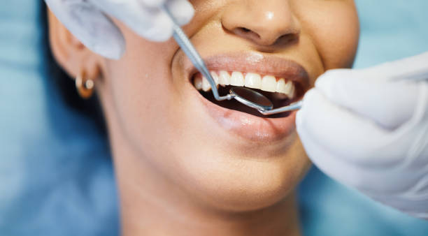 Best Emergency Cosmetic Dentistry (e.g., broken veneers) in Perezville, TX